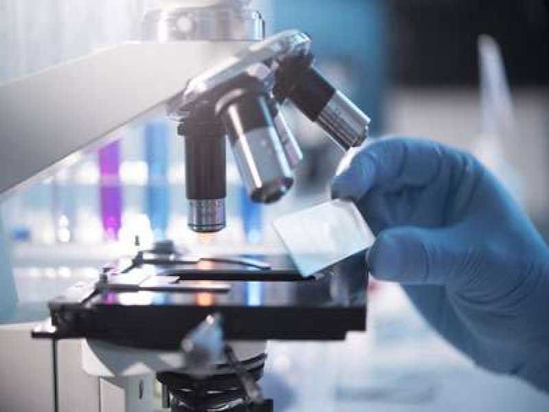 भारत में मिला कोरोना का नया ‘AP स्ट्रेन’, 15 गुना अधिक संक्रामक - तीन दिन मे कर रहा बीमार