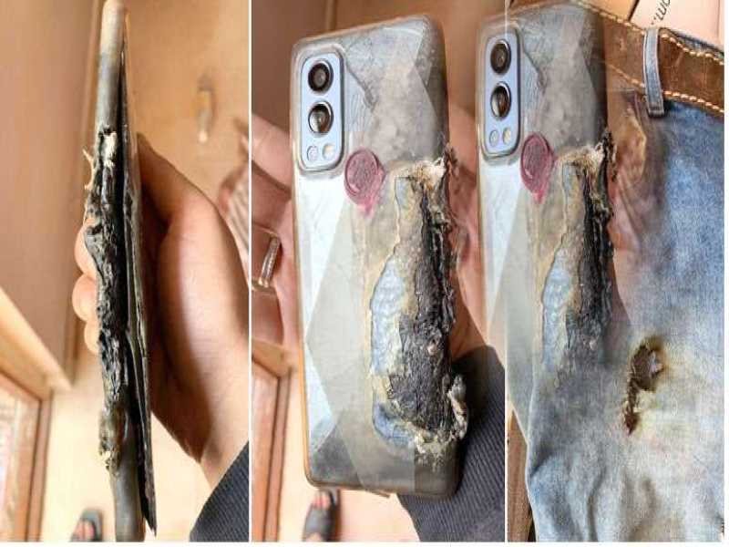OnePlus Nord 2 स्‍मार्टफोन एक बार फिर विस्‍फोट हुआ : जल गई यूजर्स की जांघ